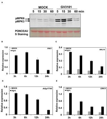 MKK4/5-MPK3/6 Cascade Regulates Agrobacterium-Mediated Transformation by Modulating Plant Immunity in Arabidopsis